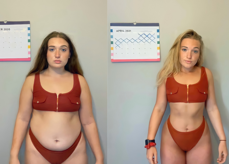 6-week-belly-ozempic-weight-loss-before-and-after-result